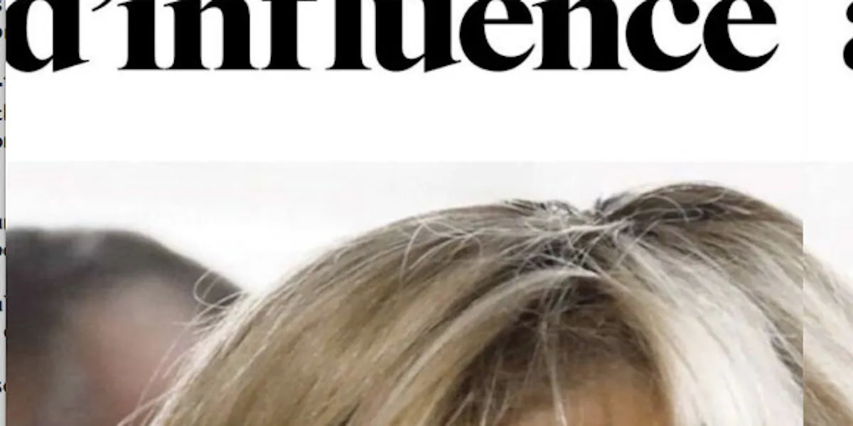 Brigitte Macron, La Métamorphose Mystérieuse : L'opération De Chirurgie ...